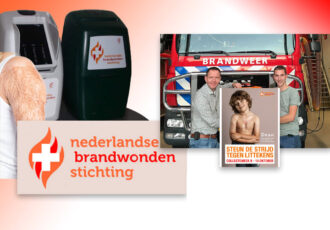 Steun de strijd tegen littekens